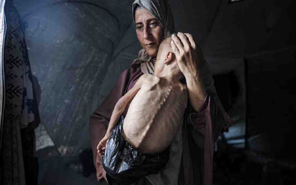 300 شهيد جراء التجويع في غزة